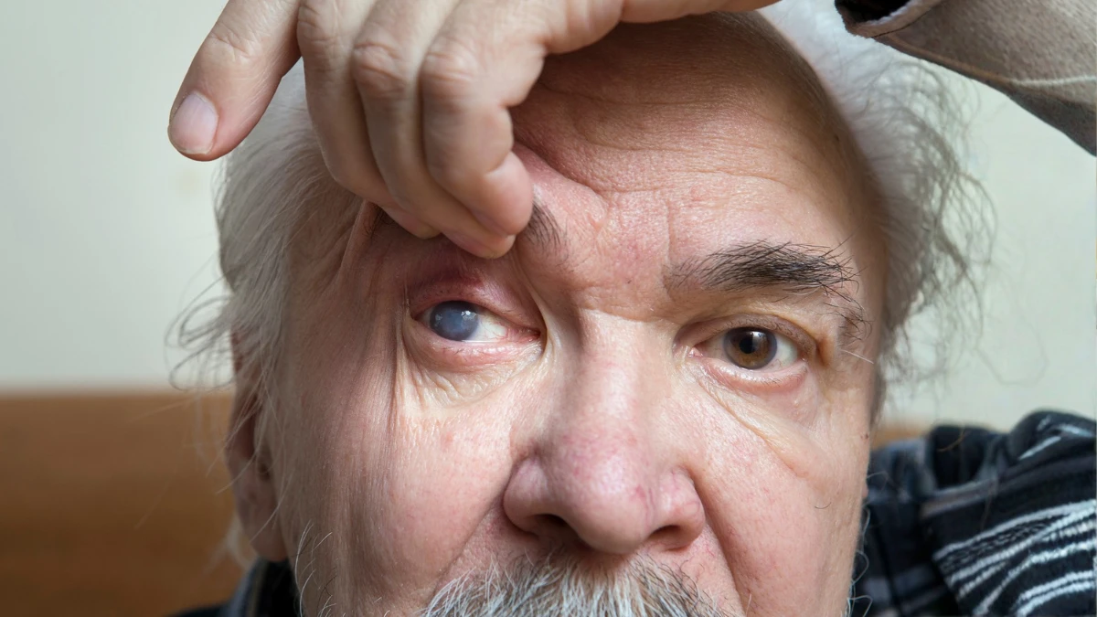 11 Eye Symptoms After 50 You Should Never Ignore Ophthalmologists Say #5 Means Go to the ER Today
