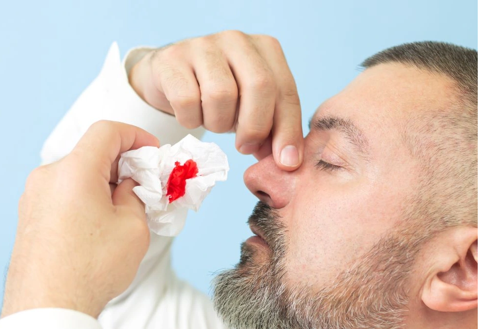 Bruising Along With Other Bleeding Symptoms
