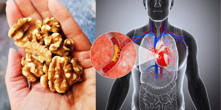 How Walnuts May Affect Angiogenesis