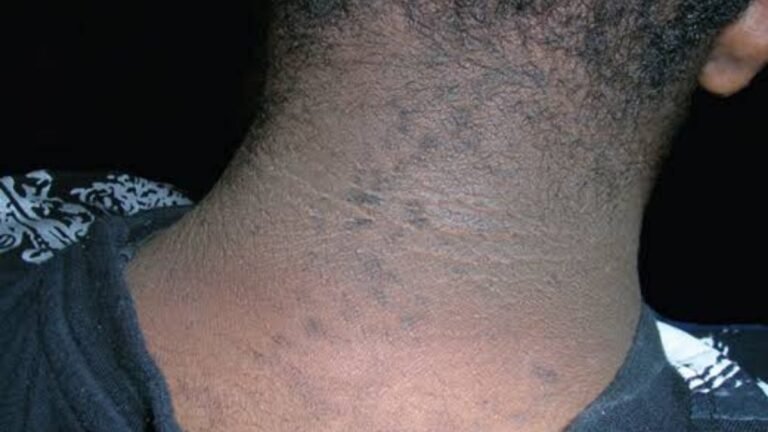 I’m an Endocrinologist: There’s a Skin Patch on Your Neck I Can Diagnose From Across the Room