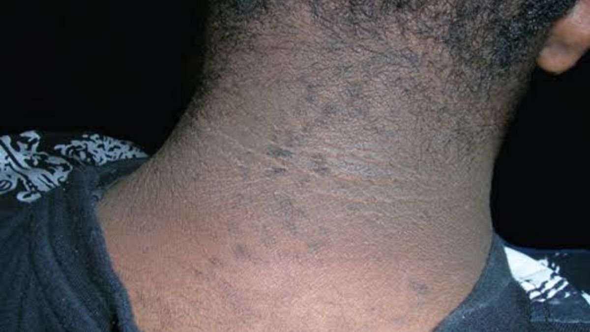 I'm an Endocrinologist There's a Skin Patch on Your Neck I Can Diagnose From Across the Room