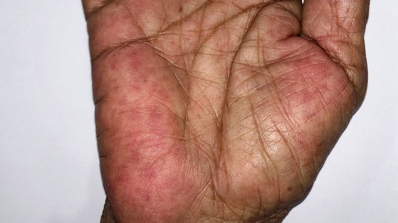 Palms That Look Unusually Red