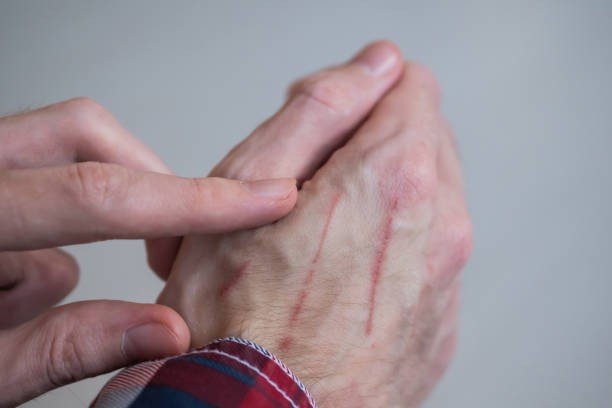 Scratch Marks That Keep Returning