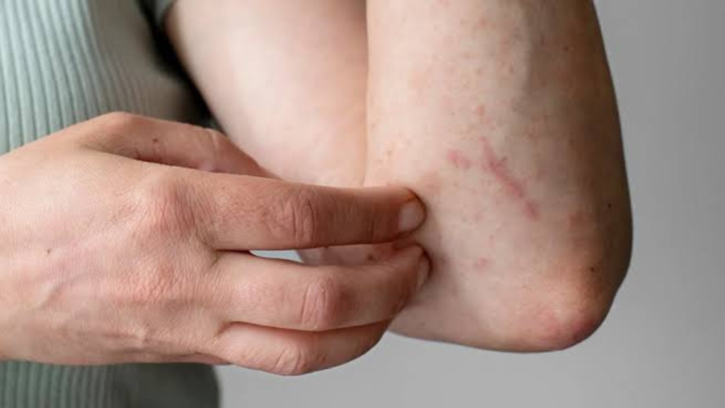 Slow Healing, Repeat Infections, and Itch That Will Not Quit