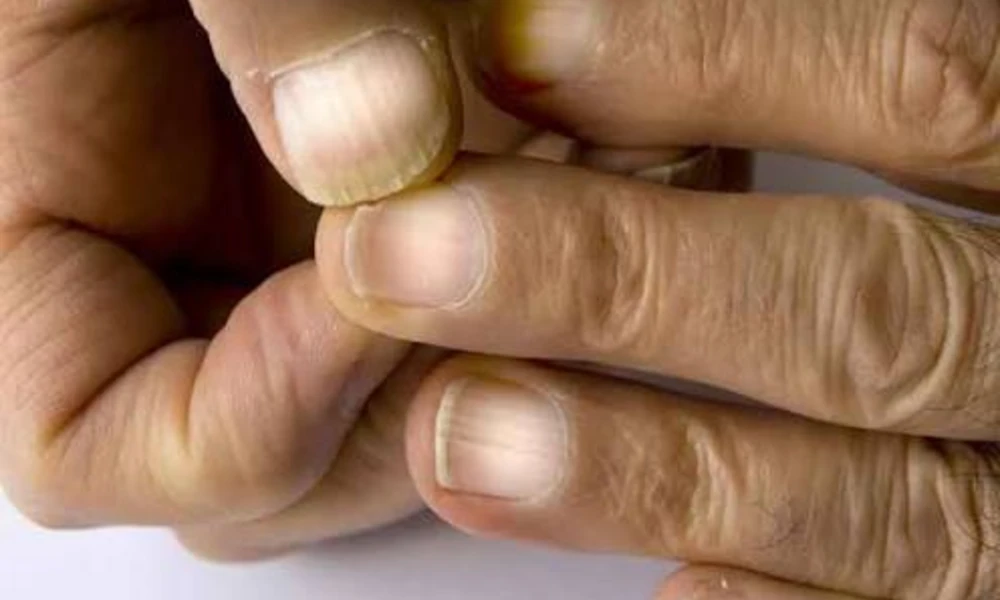 Terry Nails (White Nails with a Pink Band)