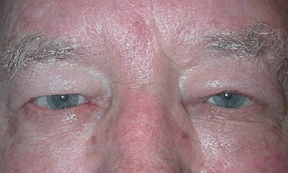 The Edges of Your Eyelids
