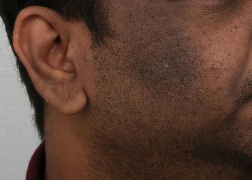 The Hidden Link Between Your Skin and Blood Sugar