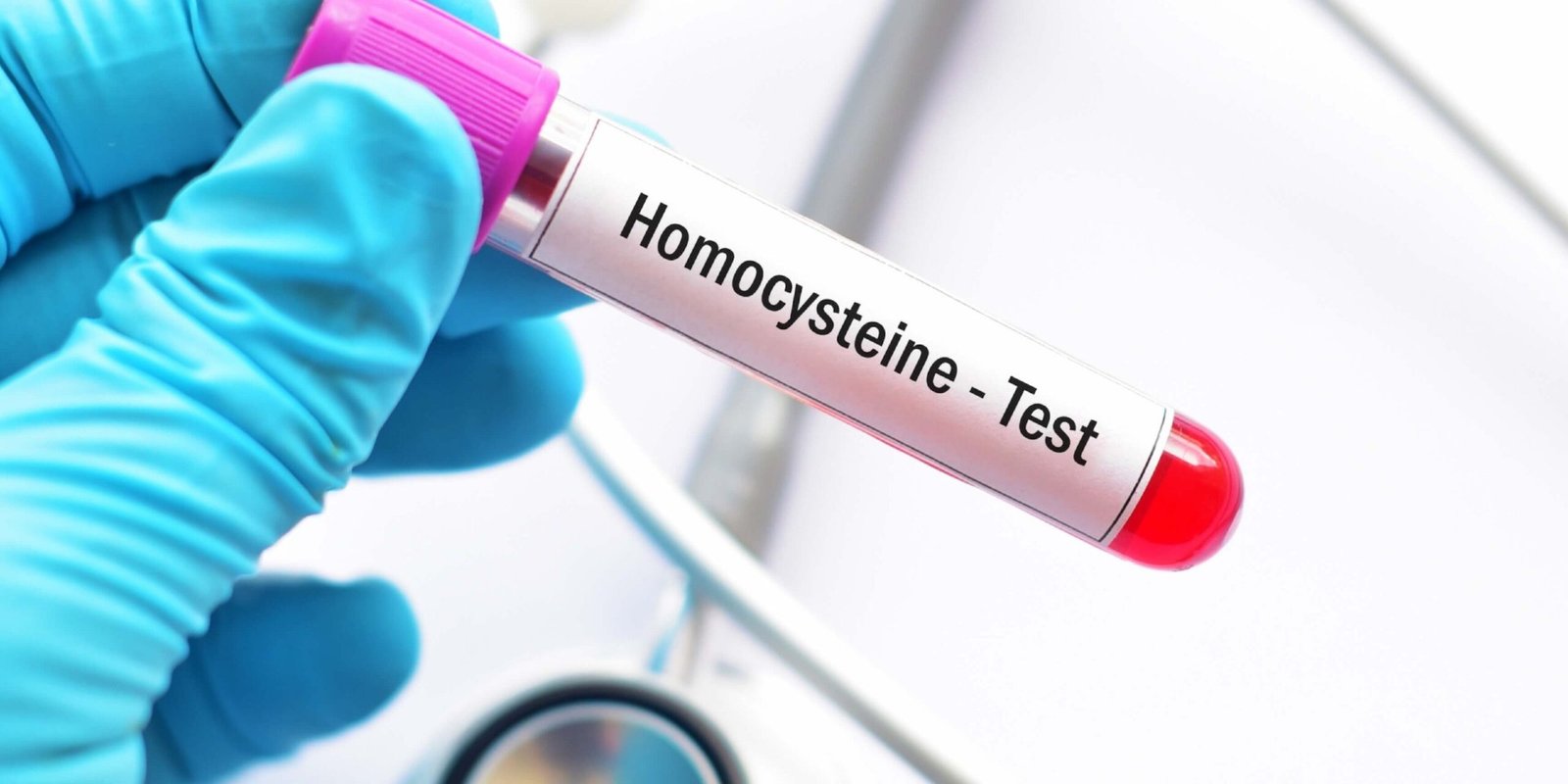 The MMA And Homocysteine Tests