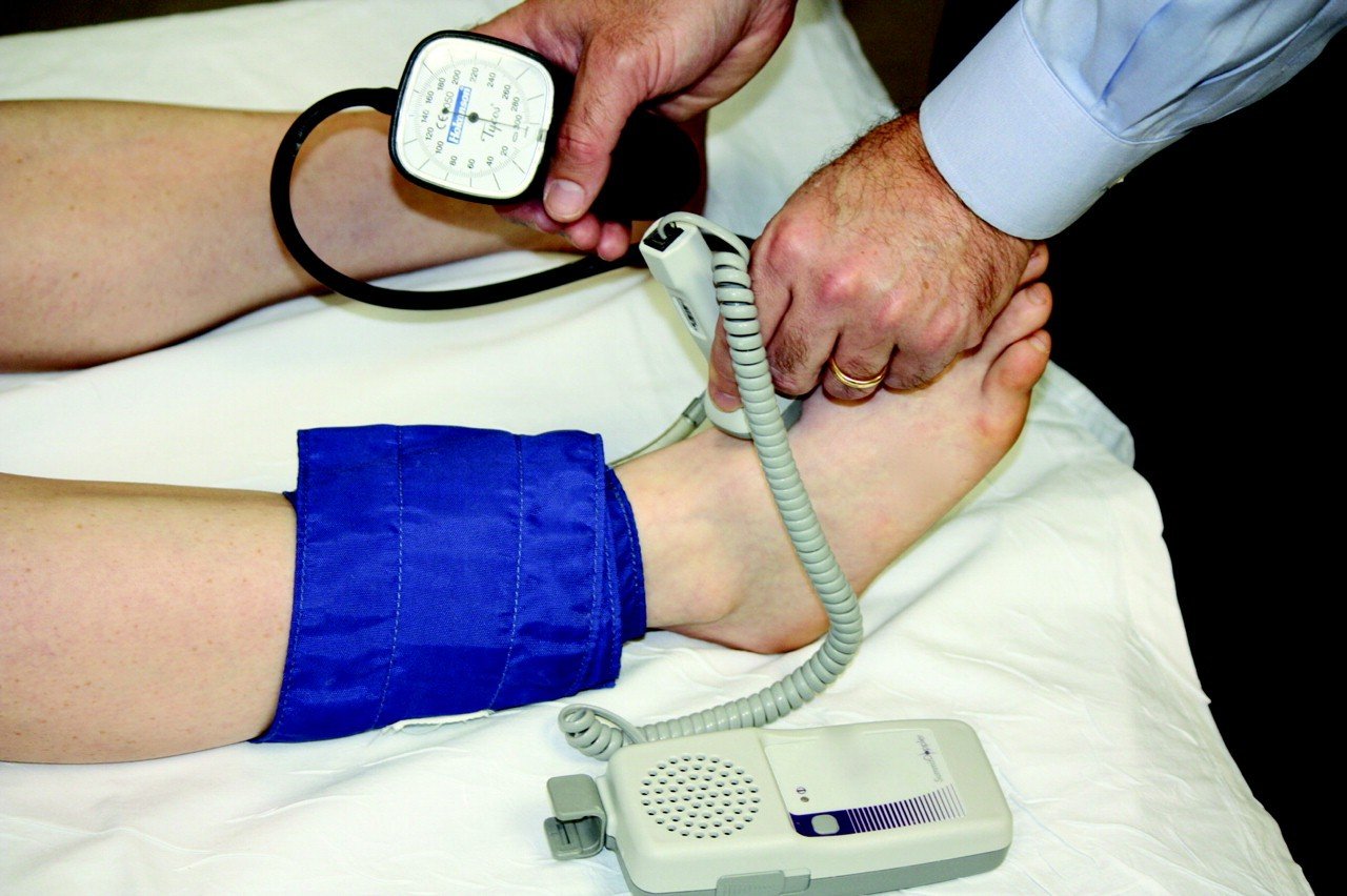 The Simple Ankle Brachial Index Test