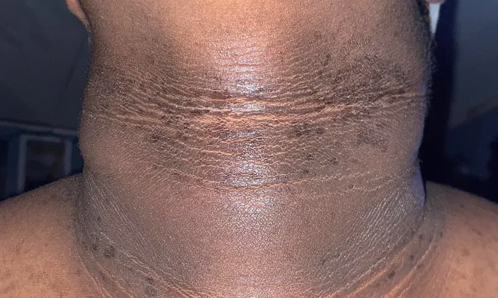The Skin Clue Worth Paying Attention To