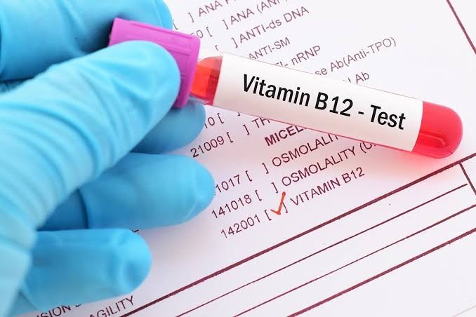 The Specific Blood Tests You Must Request