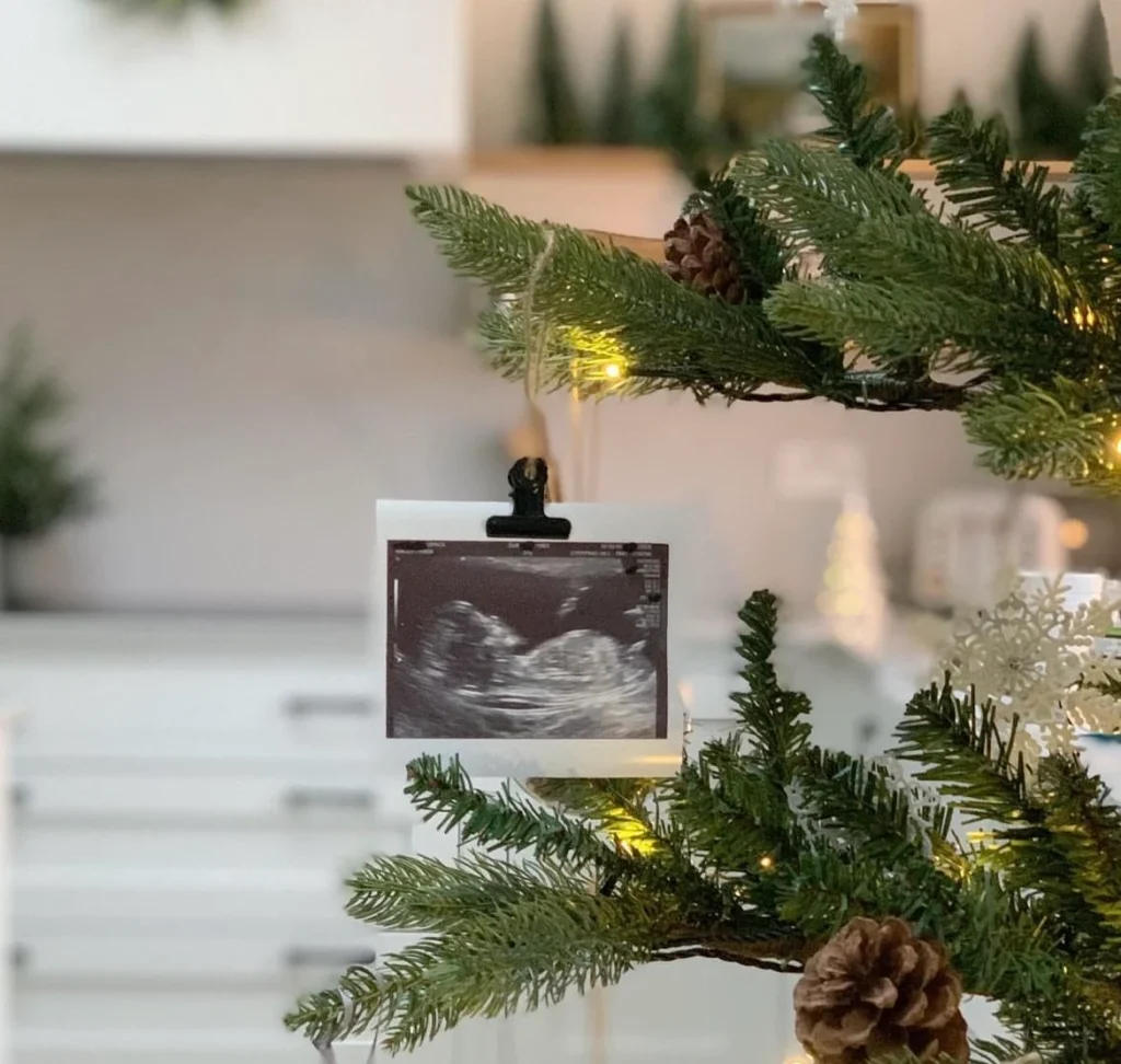 Ultrasound Ornament on Christmas Tree