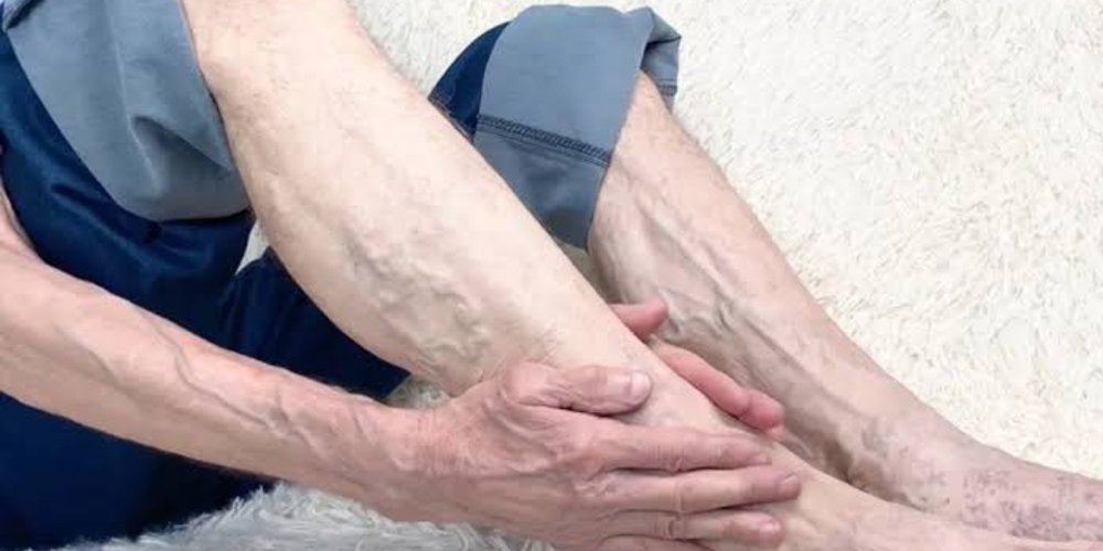 Veins That Suddenly Bulge And Feel Hard