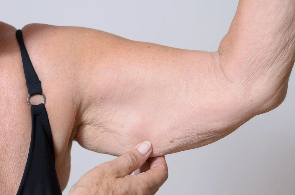 What Muscle Loss Looks Like Before It Becomes a Crisis