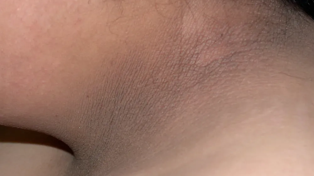 What This Skin Patch Does Not Mean