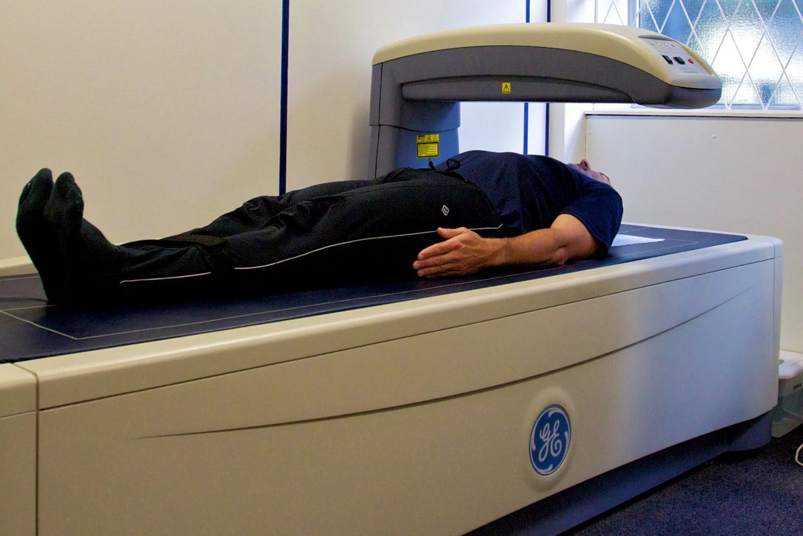 What a DEXA Scan Actually Tells You