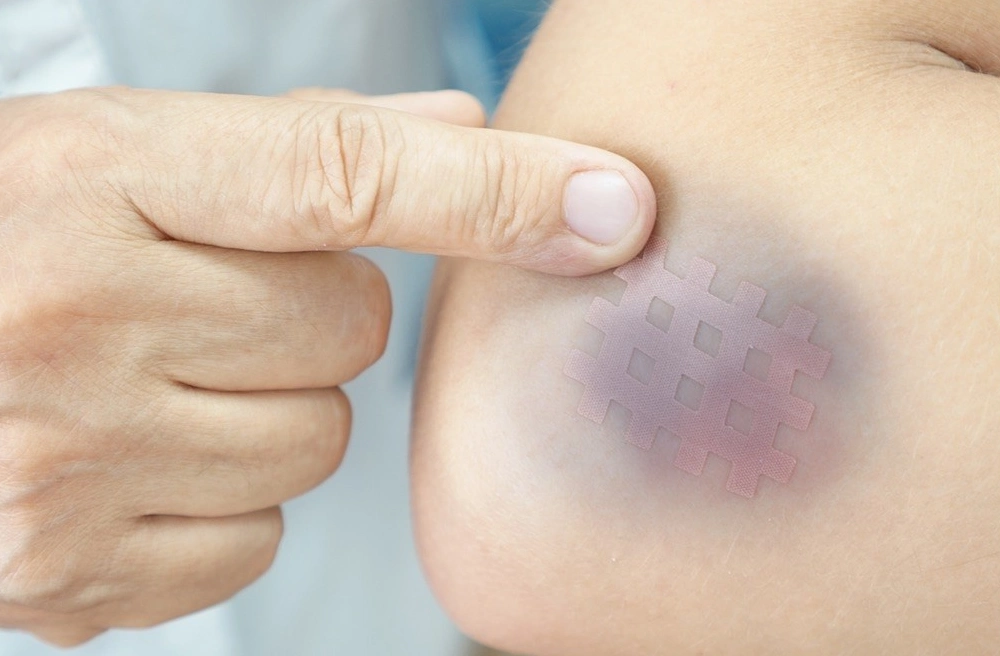 When Bruising After 50 Needs Medical Attention