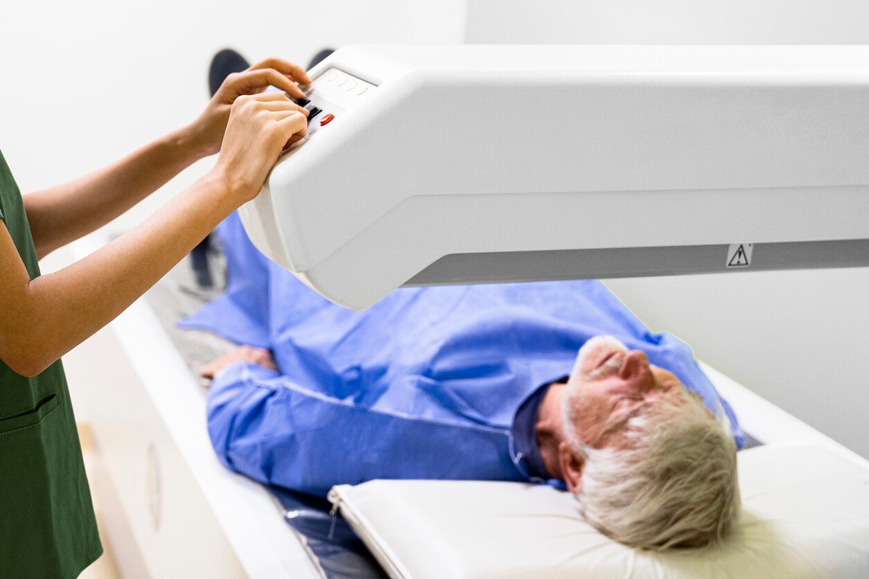 Who Should Ask About a Bone Density Test?