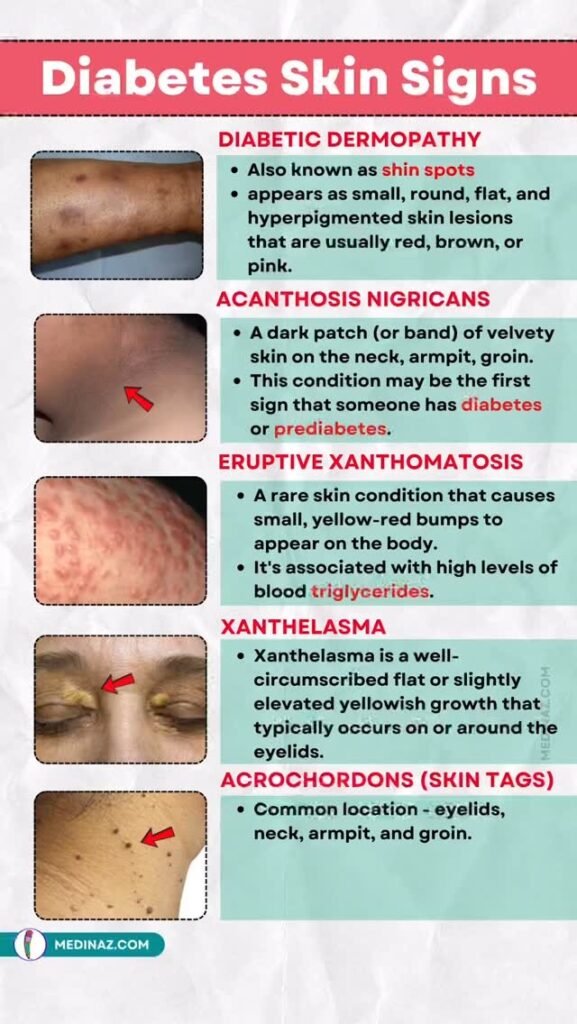 Why Your Skin Knows Before Your Blood Test Does