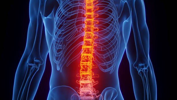 You Have Had More Than One Fracture Since Turning 50