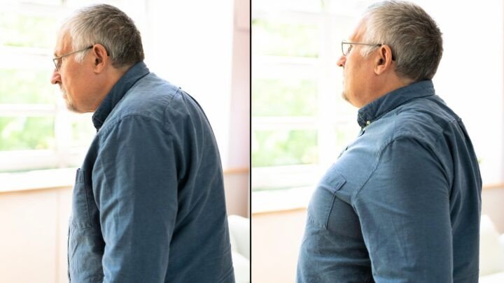 Your Upper Back Is Becoming More Rounded