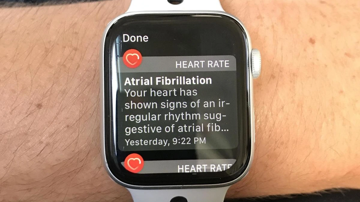 Irregular Heart Rhythm Warnings